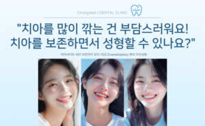 쁘띠 치아 성형 (Enameloplasty 법랑질 성형) 에 대해 알아보아요!