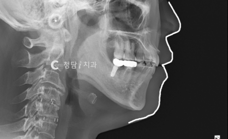 시술후 사진