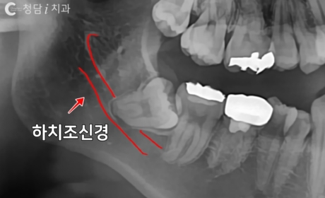 시술전 사진